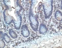 Anti-CCR10 antibody used in IHC (Paraffin sections) (IHC-P). GTX23904