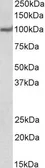 Anti-USP4 antibody, N-term used in Western Blot (WB). GTX24546