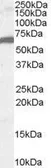 Anti-FOXA2 antibody, C-term used in Western Blot (WB). GTX25074