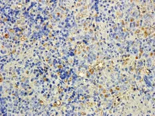 Anti-MTMR9 antibody, C-term used in IHC (Paraffin sections) (IHC-P). GTX25075