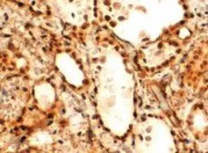 Anti-FOXE1 antibody, C-term used in IHC (Paraffin sections) (IHC-P). GTX25080