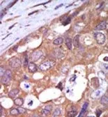 Anti-PKC mu antibody used in IHC (Paraffin sections) (IHC-P). GTX25283