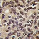 Anti-PKN beta antibody used in IHC (Paraffin sections) (IHC-P). GTX25440