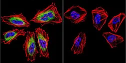 Anti-Calpain 1 antibody [2H2A7C2] used in Immunocytochemistry/ Immunofluorescence (ICC/IF). GTX25441