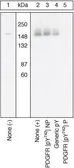 Anti-PDGF Receptor alpha (phospho Tyr742) antibody used in Western Blot (WB). GTX25452