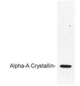 Anti-alpha A Crystallin antibody used in Western Blot (WB). GTX25595