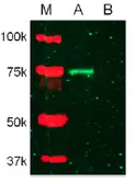 Anti-MMP2 antibody used in Western Blot (WB). GTX25704