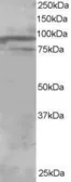 Anti-OSBPL11 antibody, C-term used in Western Blot (WB). GTX25934