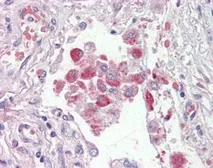 Anti-OSBPL9 antibody, C-term used in IHC (Paraffin sections) (IHC-P). GTX25960