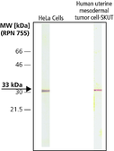 Anti-CDK4 antibody [DCS-31] used in Western Blot (WB). GTX26315
