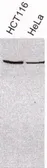 Anti-XRCC3 antibody used in Western Blot (WB). GTX26494
