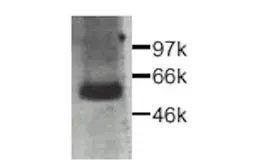 Anti-CTGF antibody used in Western Blot (WB). GTX26992