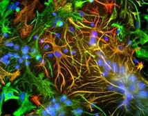 Anti-GFAP antibody used in Immunocytochemistry/ Immunofluorescence (ICC/IF). GTX27260