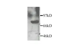 Anti-MMP2 antibody used in Western Blot (WB). GTX27298