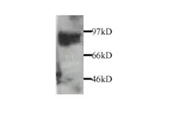 Anti-MMP9 antibody used in Western Blot (WB). GTX27299