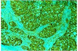 Anti-MUC1 antibody [GP1.4] used in Immunohistochemistry (IHC). GTX28203