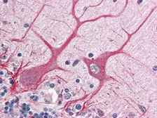 Anti-NOTCH1 antibody used in IHC (Paraffin sections) (IHC-P). GTX28387