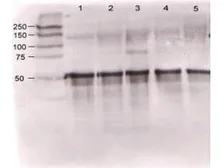 Anti-Angiopoietin 1 antibody used in Western Blot (WB). GTX28451