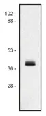 Anti-HLA Class I antibody [MEM-147] used in Western Blot (WB). GTX29090