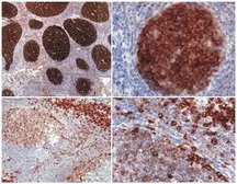 Anti-PAG antibody [MEM-255] used in IHC (Paraffin sections) (IHC-P). GTX29527