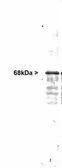 Anti-NF-L antibody used in Western Blot (WB). GTX30190