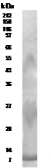 Anti-RELM beta antibody used in Western Blot (WB). GTX30435