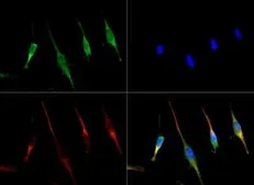 Anti-SLC31A1 / CTR1 antibody used in Immunocytochemistry/ Immunofluorescence (ICC/IF). GTX30642