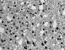 Anti-HIF1AN antibody used in Immunohistochemistry (IHC). GTX30646