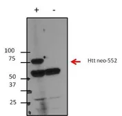 Anti-Huntingtin (neoepitope 552) antibody [4-13] used in Western Blot (WB). GTX30673