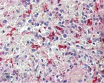Anti-Heme Oxygenase 1 antibody used in IHC (Paraffin sections) (IHC-P). GTX30748