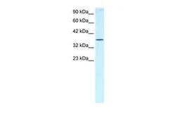 Anti-HOXA7 antibody, N-term used in Western Blot (WB). GTX30912