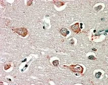 Anti-GABA A Receptor beta 3 antibody, Internal used in IHC (Paraffin sections) (IHC-P). GTX31010