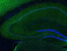 Anti-IL1 alpha antibody used in Immunohistochemistry (IHC). GTX31177
