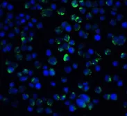 Anti-IL21 Receptor antibody used in Immunocytochemistry/ Immunofluorescence (ICC/IF). GTX31271