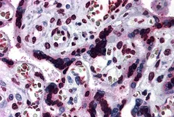 Anti-CARD14 antibody used in IHC (Paraffin sections) (IHC-P). GTX31281