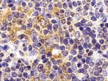 Anti-TLR9 antibody used in IHC (Paraffin sections) (IHC-P). GTX31294