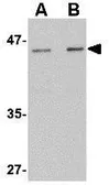 Anti-LASS5 antibody used in Western Blot (WB). GTX31350