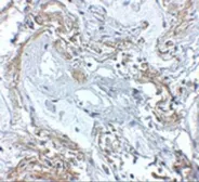 Anti-TNFAIP3 antibody used in IHC (Paraffin sections) (IHC-P). GTX31376