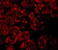 Anti-JMJD8 antibody used in IHC (Paraffin sections) (IHC-P). GTX31388