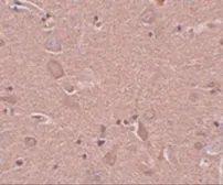 Anti-SRPX antibody used in IHC (Paraffin sections) (IHC-P). GTX31394
