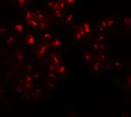 Anti-EZH2 antibody used in Immunocytochemistry/ Immunofluorescence (ICC/IF). GTX31435