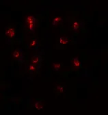 Anti-TSHZ1 antibody used in Immunocytochemistry/ Immunofluorescence (ICC/IF). GTX31472