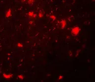 Anti-CBX4 antibody used in IHC (Paraffin sections) (IHC-P). GTX31493