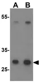 Anti-Neurogenin 2 antibody used in Western Blot (WB). GTX31509