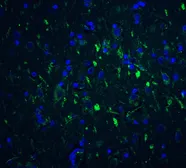 Anti-FOXP3 antibody used in IHC (Paraffin sections) (IHC-P). GTX31517