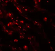 Anti-CD66e antibody used in IHC (Paraffin sections) (IHC-P). GTX31551