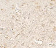 Anti-MP1 antibody used in IHC (Paraffin sections) (IHC-P). GTX31568