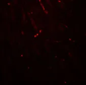 Anti-KCNK1 antibody used in IHC (Paraffin sections) (IHC-P). GTX31601