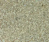 Anti-MALT1 antibody used in IHC (Paraffin sections) (IHC-P). GTX31609