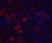 Anti-Nephrin antibody used in IHC (Paraffin sections) (IHC-P). GTX31654